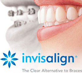 Invisalign certified dentist